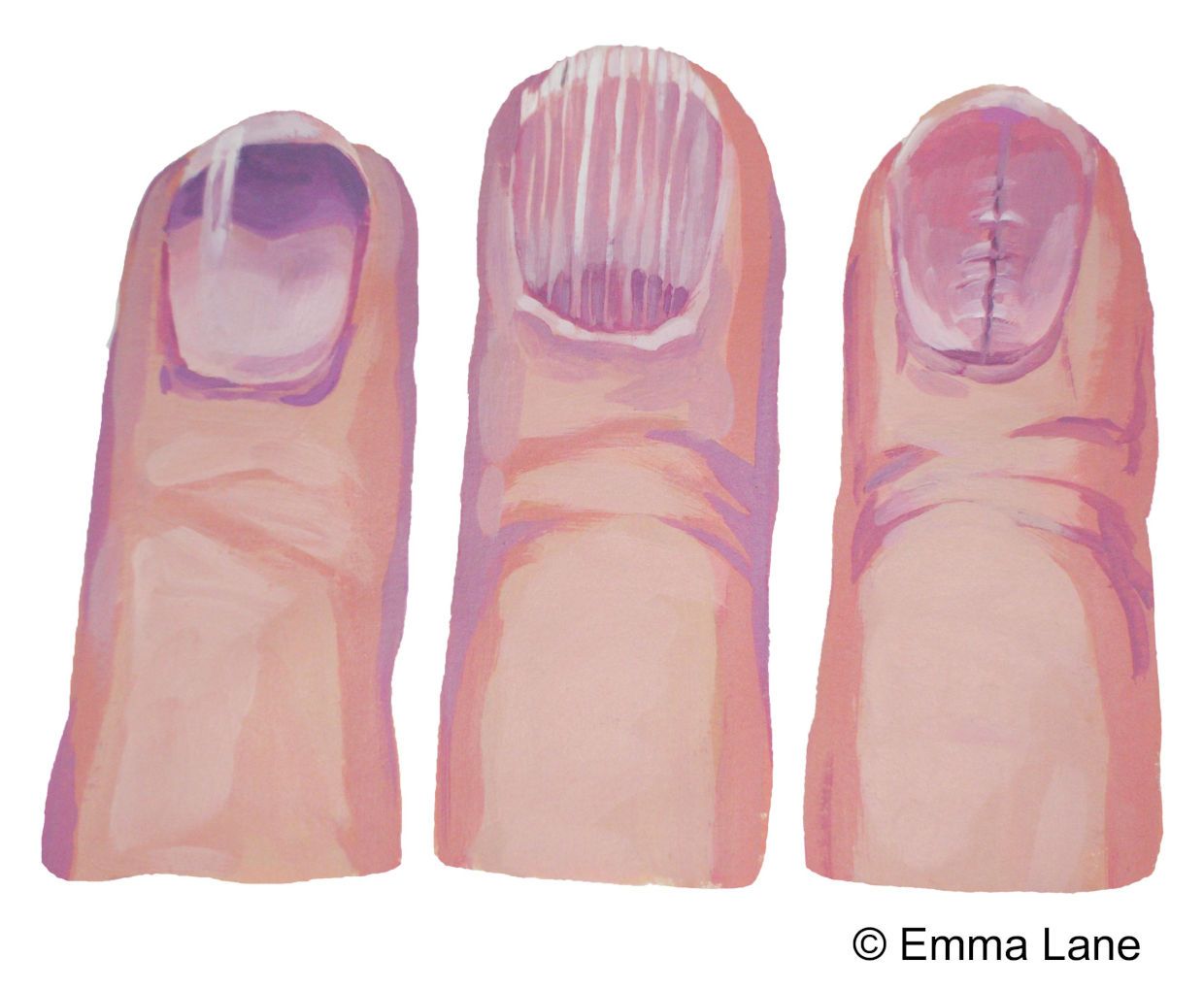 Tells of a diseased body