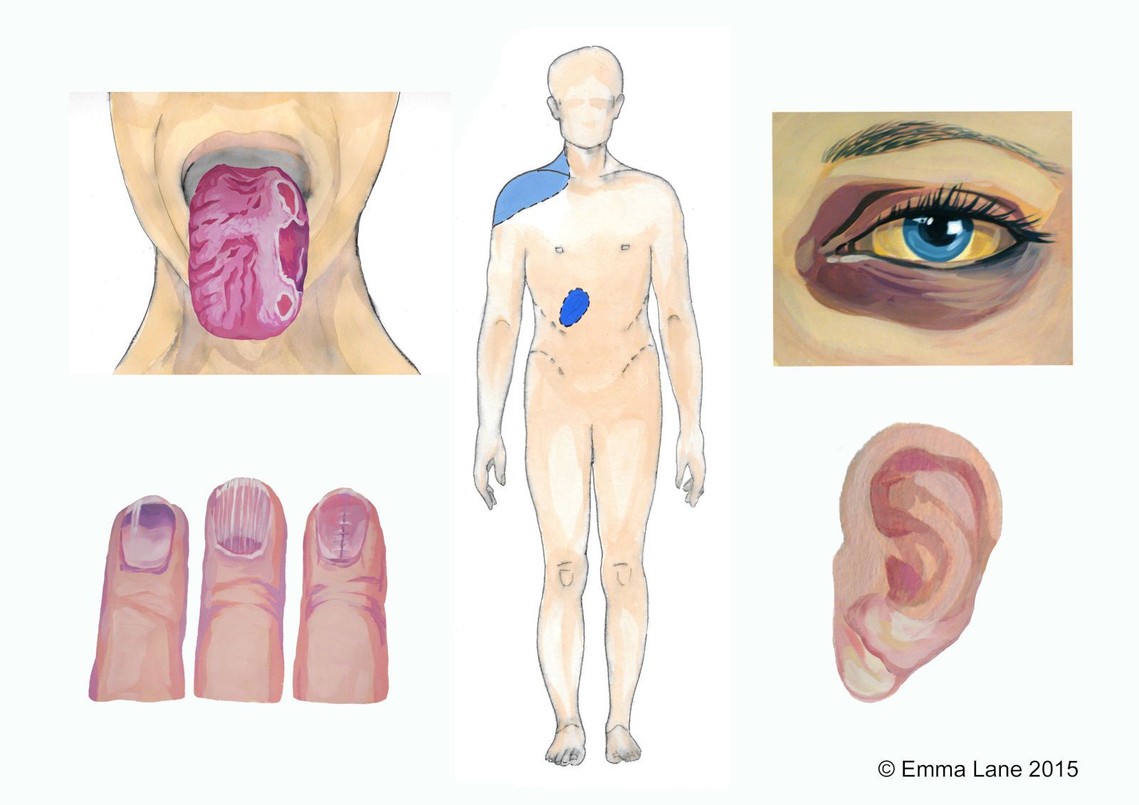 Tells of a diseased body part 2